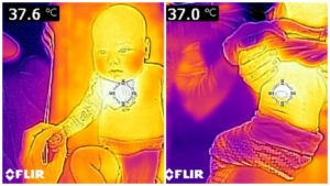 Nuotr. Taip atrodo termografu padaryta vaiko odos paviršiaus nuotrauka.